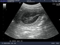 /album/fotogallerij/afro-20121119-abdomen-gr-uhd-0004-jpg/